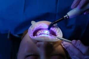 Orthodontie adulte