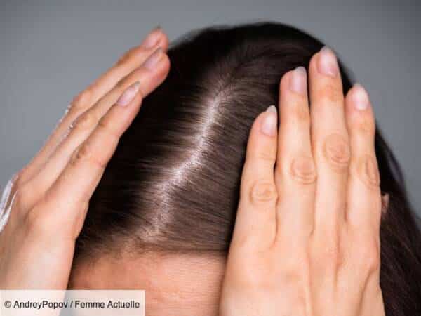 cheveux fins chance