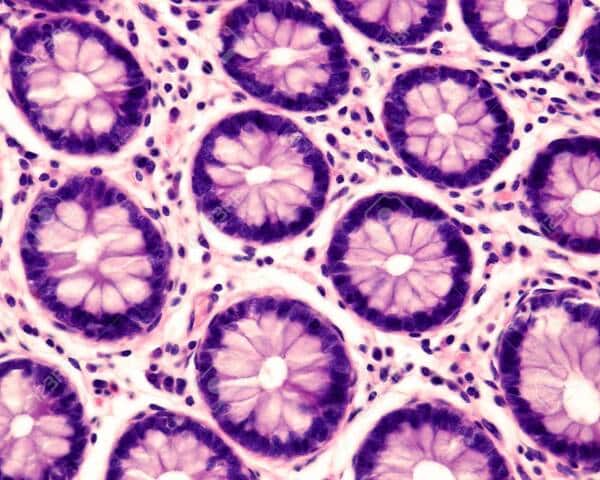 Recherche m&eacute;dicale art